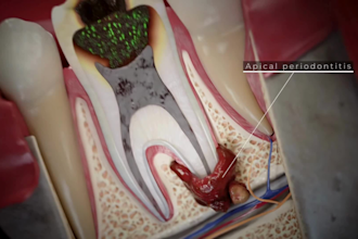 do 3d dental implant animation medical device explainer 3d dental anatomy video