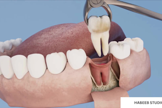 create 3d dental animation 3d dental model  for oral health explanation