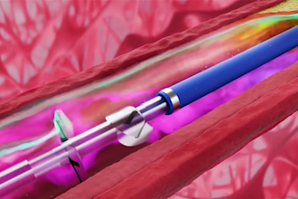 do 3d medical animation 3d surgery animation 3d dental animation anatomy