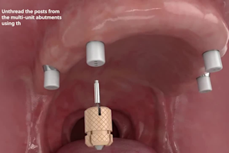do 3d medical explainer 3d dental implant animation 3d dental surgical procedure