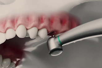 create professional 3d medical and dental animations
