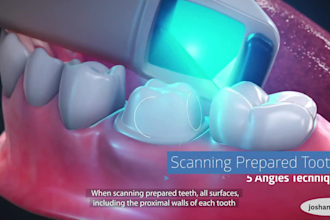 do 3d dental implant animation 3d orthodontic animation medical device animation