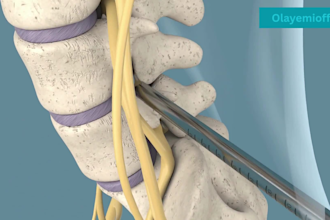 do 3d spine animation surgery animation biotech moa pharma scientific animation