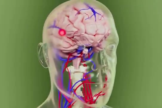 do 3d medical or technical 3d animation, 3d anatomy video 3d animation