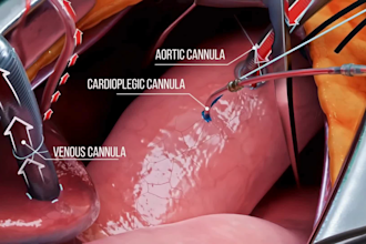 do medical animation surgical animation medical devices biomedical animation