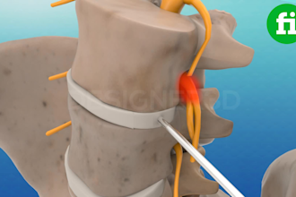 do high quality 3d medical animation