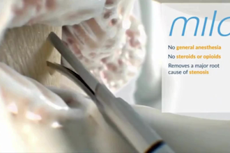 create 4k 3d medical animation,3d product demo surgery procedure explainer video