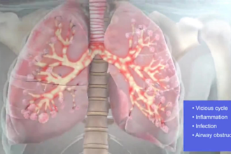 do 3d medical animation, medical videos 3d medical explainer and medical reels