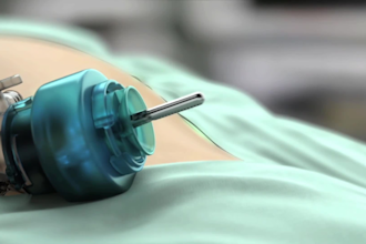 create 3d medical animation and surgical animation
