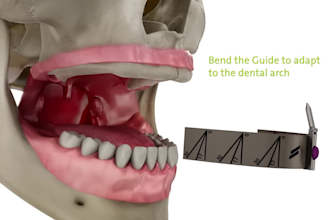 offer 3d medical dental animation 3d dental implant animation, anatomy animation