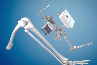 do 3d medical device animation 3d surgical device animation 3d orthopedic video
