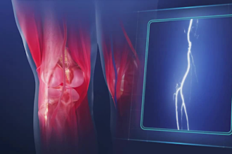 do 3d medical product animation 3d medical device 3d surgical anatomy scientific