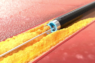 create realistic 3d medical animation video