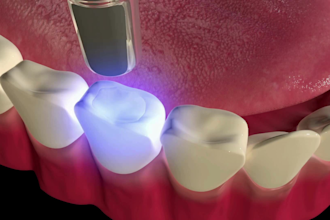 create 3d dental animation, medical animation, 3d dental explainer video