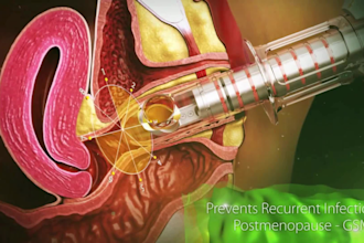 create 3d medical animation medical device animation and mechanism action video