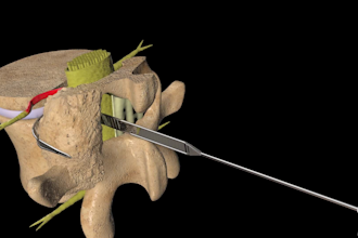 do 3d medical animation