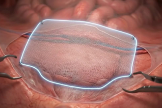 create 3d medical animation,surgical animation and medical explainer video