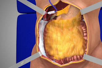 create 3d medical animation video, surgery and anatomy