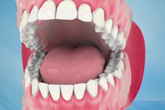 create realistic 3d dental impact and medical animation video