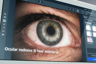create 3d medical device animation for medtech, surgical and healthcare product