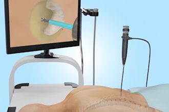 create 3d medical animation surgical procedure medical device animation video