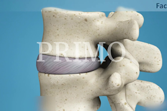 create 3d animation for spine surgery, animation explainer video, 3d anatomy