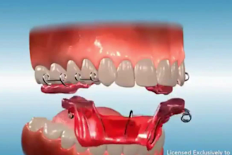 do 3d orthodontic braces, twin blocks, dental and explainer video animation