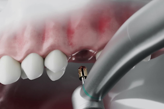 do 3d medical animation 3d surgery animation 3d explainer video