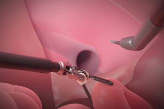 create realistic 3d surgical procedure animation surgical animation video