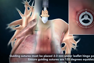 create high quality 3d medical animation medical surgery animated explainer