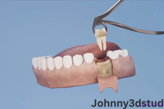 create 3d dental implants animation, dental surgery , 3d medical video