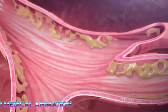 create high quality 3d medical anatomy dental surgical procedure animation video