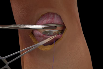 create medical animation video