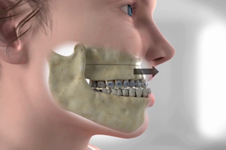 do aesthetic 3d medical animation surgery anatomy 3d medical scientific video