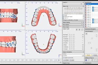 plan your invisible dental aligners cases