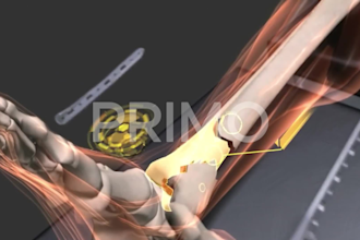 create 3d medical animation 3d orthopedic animation medical 3d surgery animation