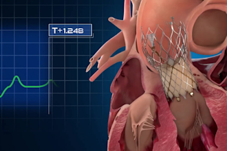 3d medical explainer, dental, scientific, surgery, anatomy, 3d medical animation