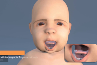 do 3d medical animation 3d medical explainer anatomy video 3d surgery video