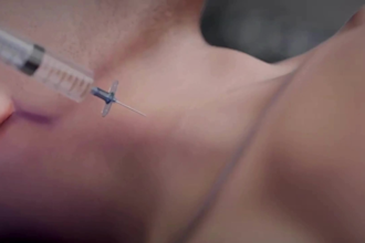 do aesthetic 3d medical animation 3d animation video 3d medical video