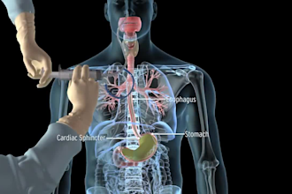 medical, healthcare animated explainer video medical animation patient education