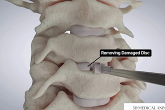 create 3d medical animation, 3d medical device animation, 3d anatomy animation