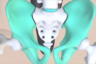 create 4k 3d medical animation 3d product demo surgery procedure explainer video