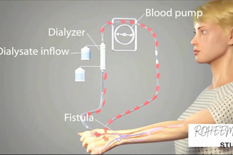 create high quality 3d medical animation surgical explainer medical illustration