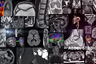 do 3d medical device explainer 3d medical animation 3d anatomy surgery animation