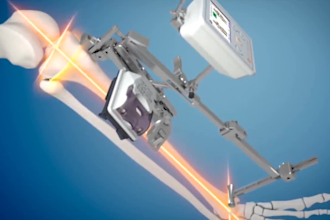 do 3d medical animation surgical procedure, knee replacement, orthopedic implant
