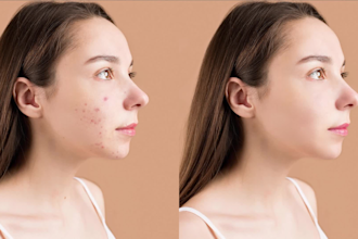 do high end skin retouching, photo retouching, and any photoshop editing