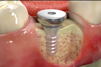 do 3d medical animation and medical explainer video