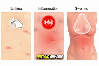 create 3d medical animation, medical explainer video, surgical animation video