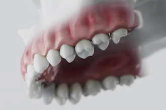 do 3d dental animation, 3d implant animation, 3d surgery animation, 3d medical