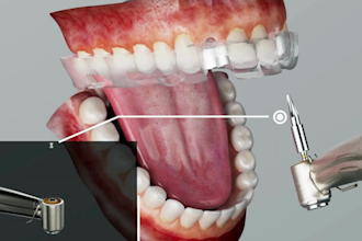 create 3d dental implant animation for patient education and clinic marketing
